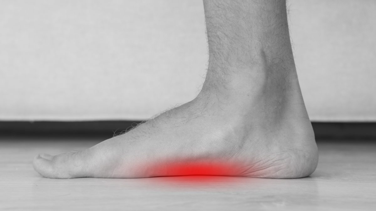 Image of flat foot pain